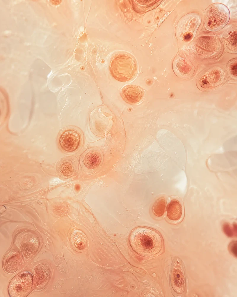 Zombie Cells in Your Skin: Cellular Aging (Senescence)