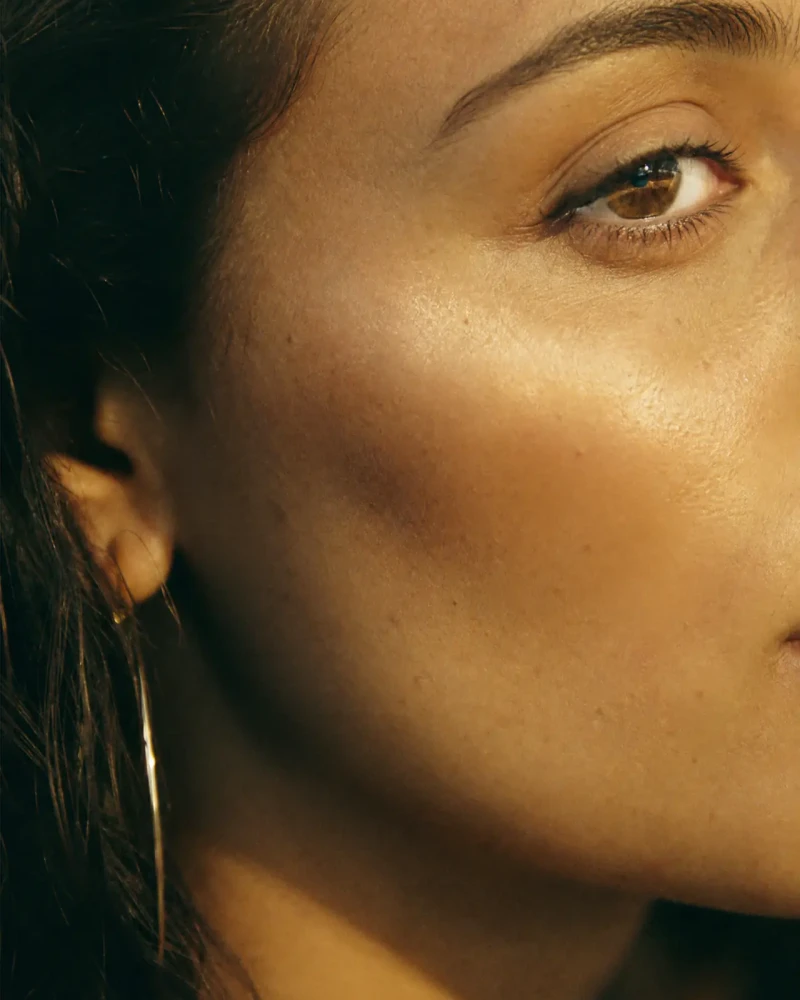 Cheekbone Filler