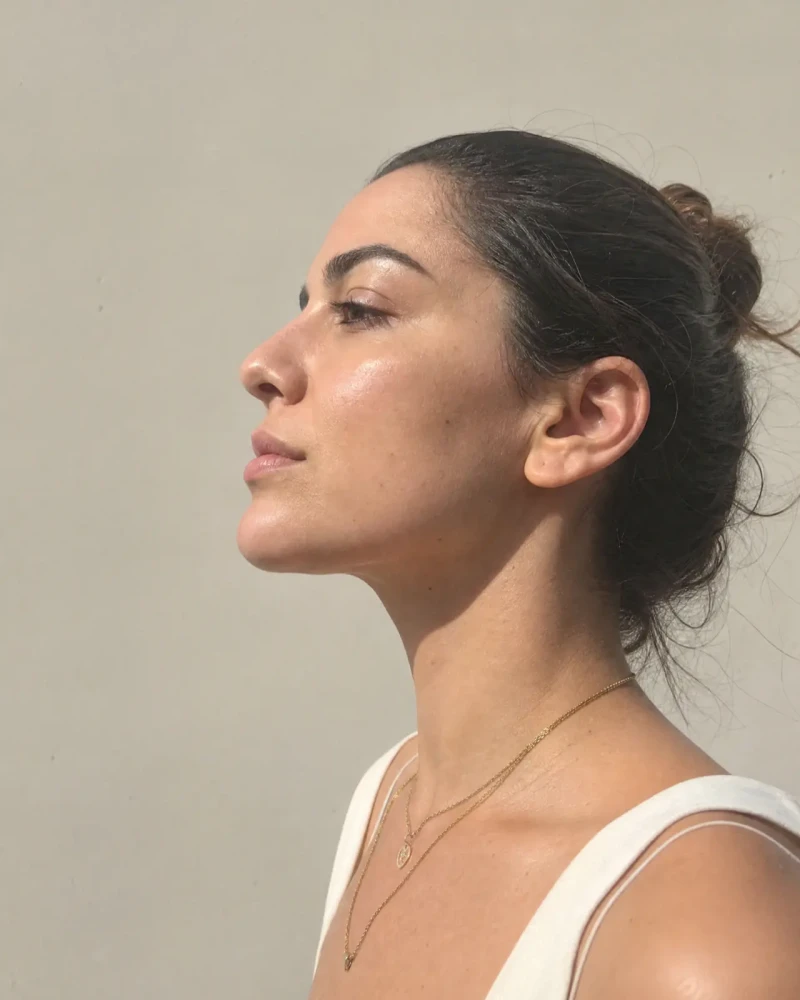 Gıdı Eritme (Çene Altı Lipolizi)